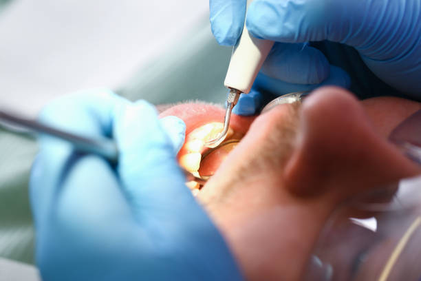Best Cracked Tooth Emergency Dentist  in Shingletown, CA