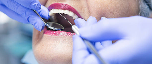 Best Chipped Tooth Repair Near Me  in Shingletown, CA